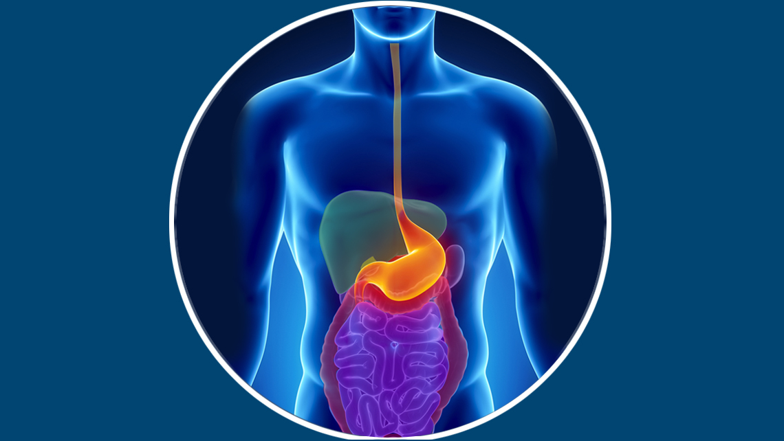 les Pathologies, cancer du colon, gastroscopie, constipation, ulcère, estomac, irritation, colon, hemeroide,